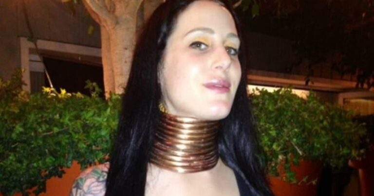 5 anos depois “Mulher Girafa” tira os anéis de metal do pescoço e choca a internet ao mostrar o resultado