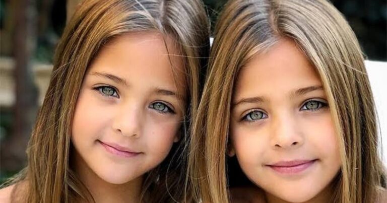 Lembra das gêmeas mais lindas do mundo? Elas cresceram e você não vai acreditar como estão hoje