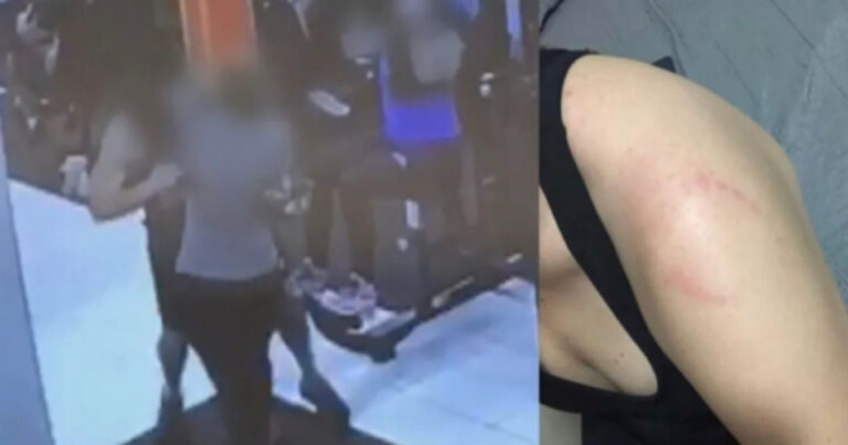 Em ataque bizarro, jovem leva mordida por esbarrar a mão em agressor; vídeo