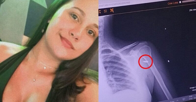 Mulher leva tiro em pagode e só percebe 4 horas depois ‘Pensei que um cupido tinha me flechado’