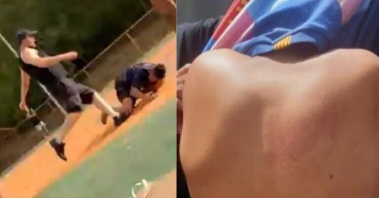 Vídeo: Adolescente é agredido porque gostava de assobiar: “Ainda sinto dor”