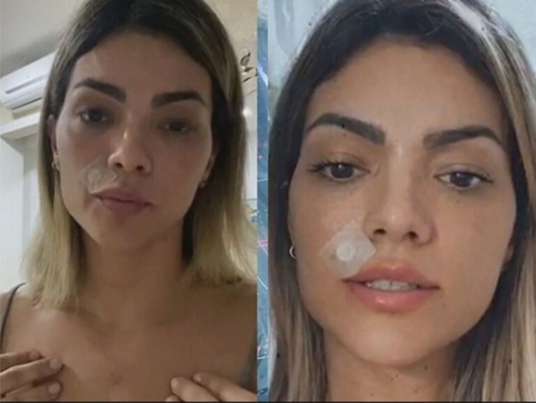 Kelly Key não esconde sofrimento e expõe luta contra grave doença: “Os últimos anos não foram fáceis”