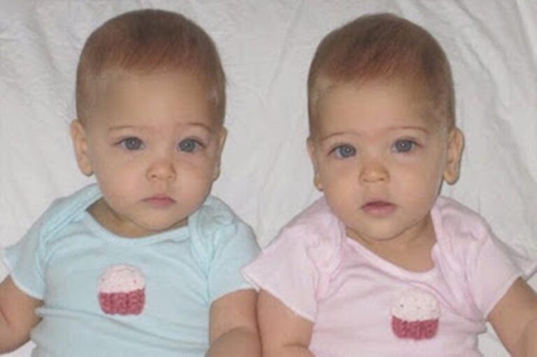 Lembra das gêmeas mais lindas do mundo? Elas cresceram e você não vai acreditar como estão hoje