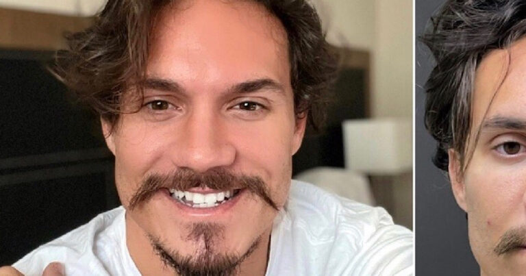 Eliezer faz procedimento no rosto, aparece irreconhecível e web pira: ‘Ficou muito gato’