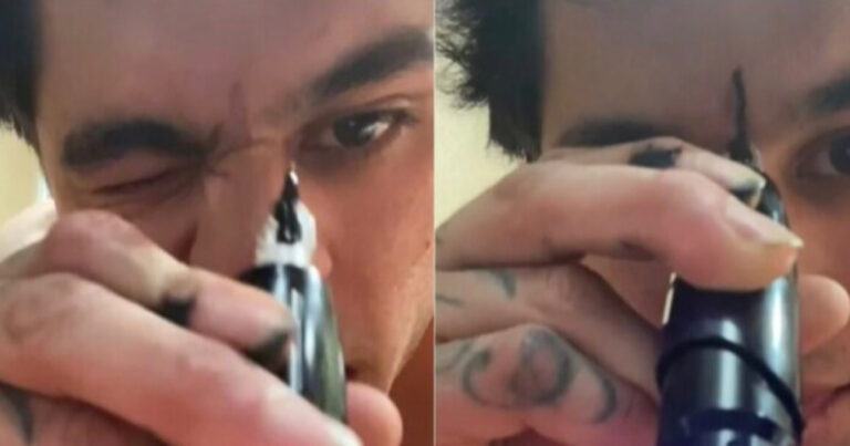 Bêbado, rapaz faz tatuagem na testa, compartilha vídeo e resultado viraliza na web