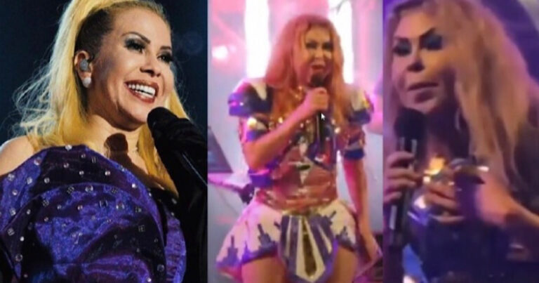 Rosto inchado da cantora Joelma deixa fãs preocupados; assessoria se manifesta e expõe motivo