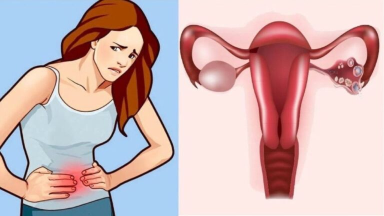 6 indicativos de que seu ovário está com cistos e você nem imaginava