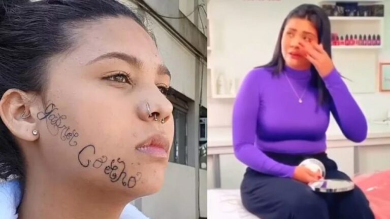 ‘Me sinto livre’, desabafa jovem ao iniciar remoção de tatuagem feita no rosto pelo ex-namorado