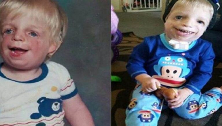Abandonado por ser feio demais ele foi adotado por família milionária, veja como ele está 35 anos depois