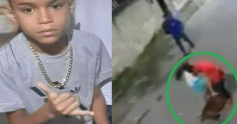 Vídeo mostra ataque de pitbull contra criança de 9 anos RJ; garoto precisou ser internado – IMAGENS FORTES