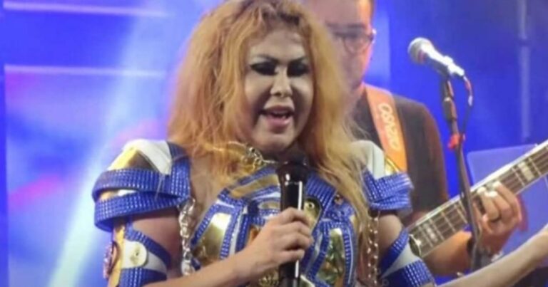 Joelma surge irreconhecível com ‘rosto deformado’, motivo é revelado e choca fãs; Vídeo