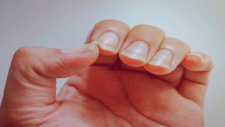 Suas unhas podem revelar os primeiros sinais de um câncer