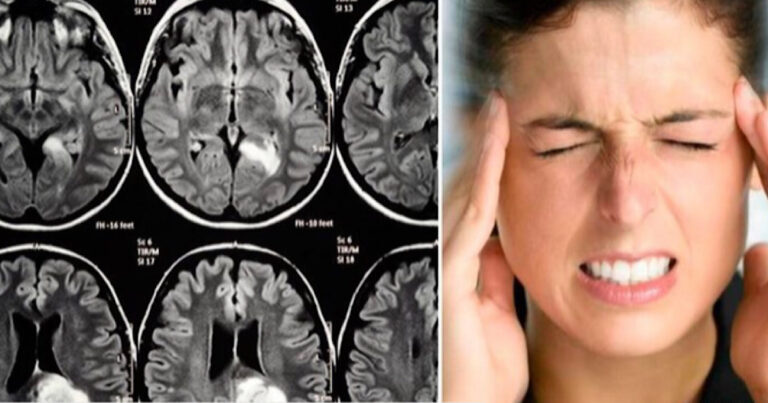Não ignore esses 5 sintomas e procure um neurologista o quanto antes