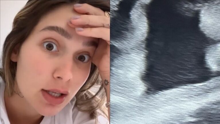 Aos seis meses, Virginia Fonseca fica eufórica ao realizar novo ultrassom: “Tá perto”