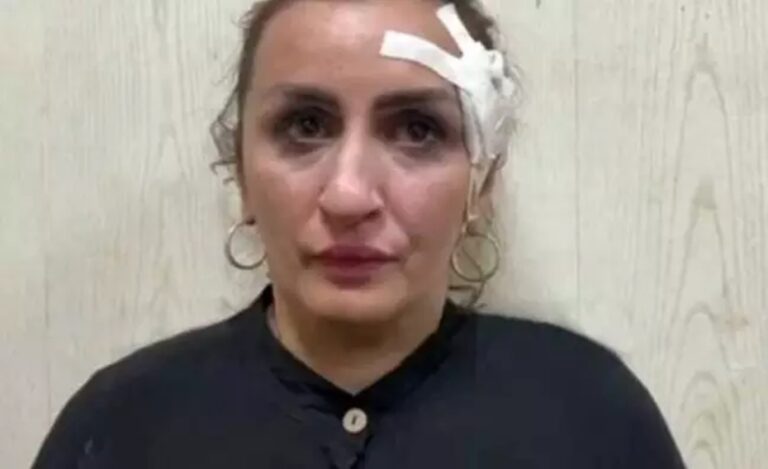 Mulher vende filho por R$ 28 mil para fazer plástica no nariz