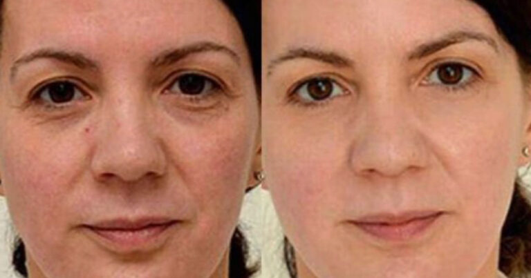 Você não vai acreditar no que essa mulher fez para conseguir essas mudanças