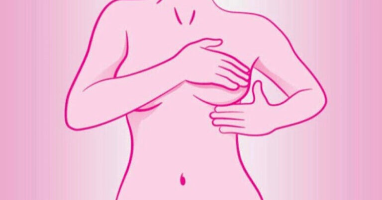 Sintomas de câncer de mama, que são ignorados por quase todas as mulheres