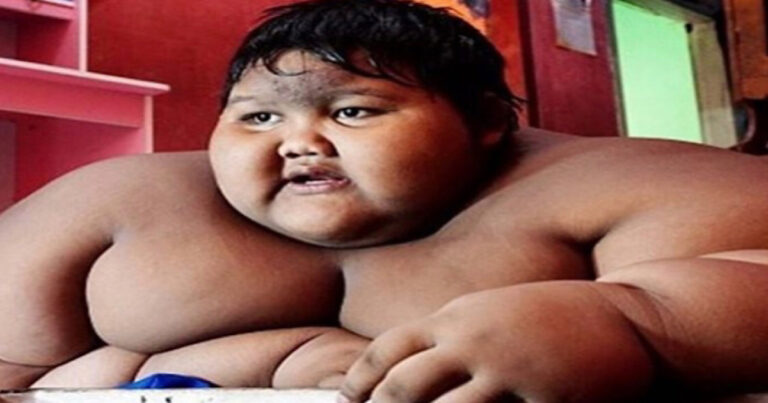 Lembra dele? Veja como está o menino ‘mais gordo do mundo’ atualmente