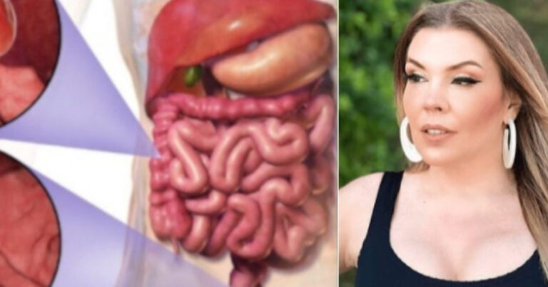Câncer de Intestino: Estes são os sintomas e causas da doença que acometeu a cantora Simony