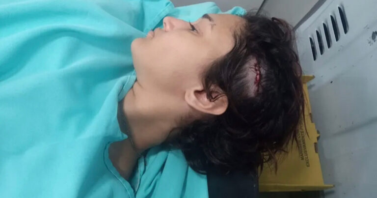 “Estou com medo de sair de casa”, diz jovem agredida por bolsonarista após fazer críticas ao presidente