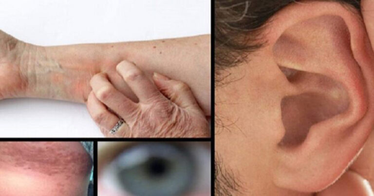 8 sintomas de pré-diabetes que você não deverá ignorar nunca
