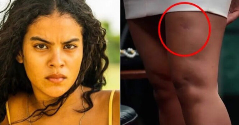O acidente nos bastidores de ‘Pantanal’ que a Globo ‘abafou’ e veio á tona chocando todos; Vídeo