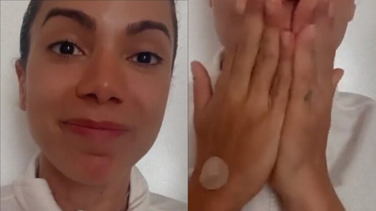 Bastante abatida, Anitta aparece com curativos e sonda escondida no pescoço