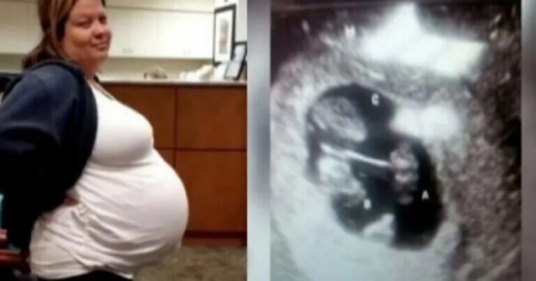 Mulher engravida após médicos dizerem que seria impossível, mas quando eles veêm o ultrassom, a sala inteira se assusta