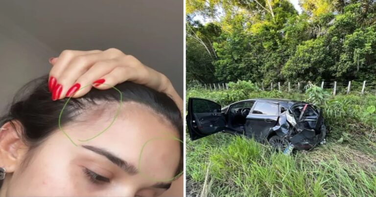Ex-BBB Gizelly Bicalho sofre grave acidente de carro e gera preocupação em fãs