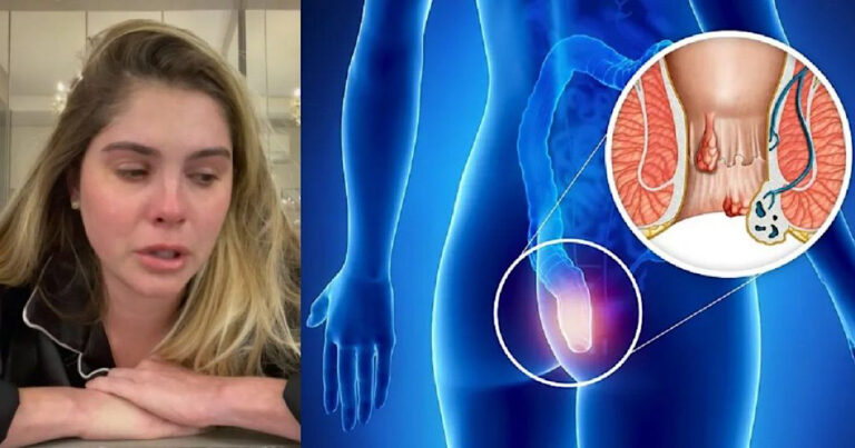 Bárbara Evans é operada às pressas após crise de choro e dores insuportáveis; diagnóstico é divulgado