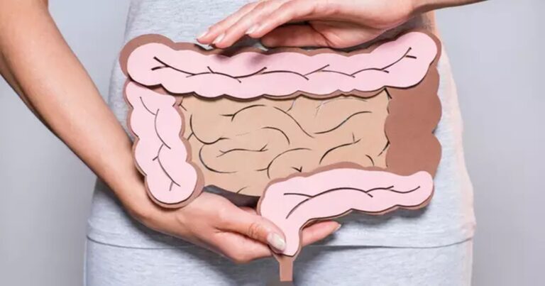 Câncer no intestino: entenda as causas e sintomas da doença