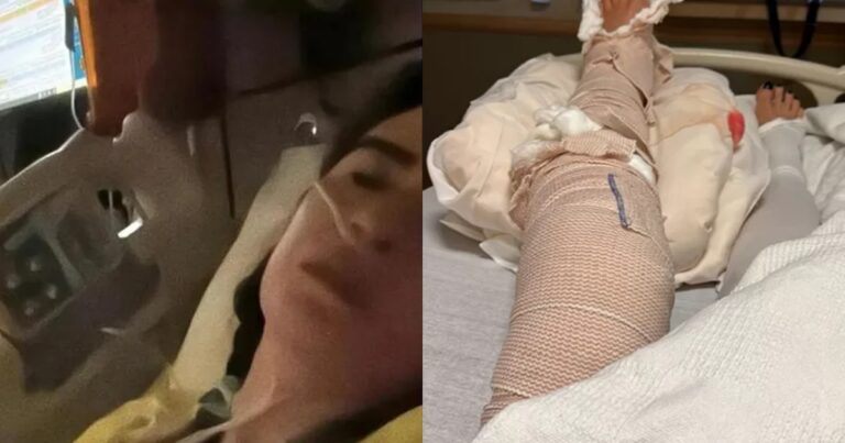 Luciana Gimenez assusta ao mostrar como a perna ficou após grave acidente e cirurgia de emergência