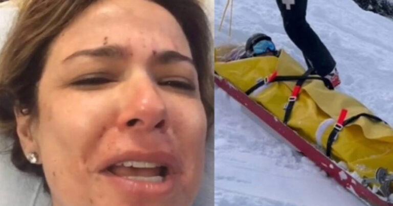 Gangrena na perna de Luciana Gimenez foi cogitada e ela diz que implorou: ‘Trabalho com isso’