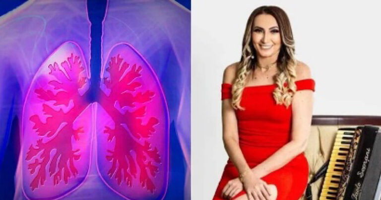 Fibrose cística: Sintomas da doença que tirou a vida da cantora Rita de Cássia