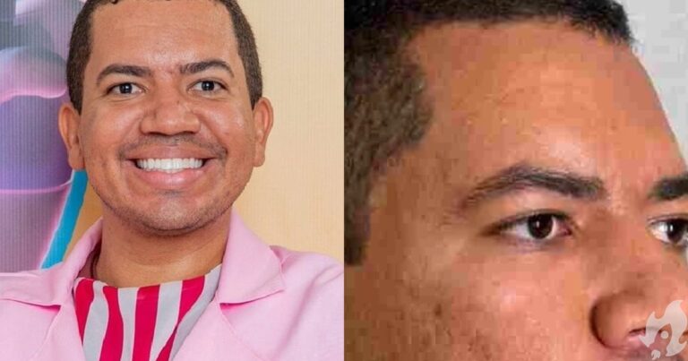 Bruno Gaga, do BBB23, gasta R$ 25 mil em harmonização facial e resultado vira piada