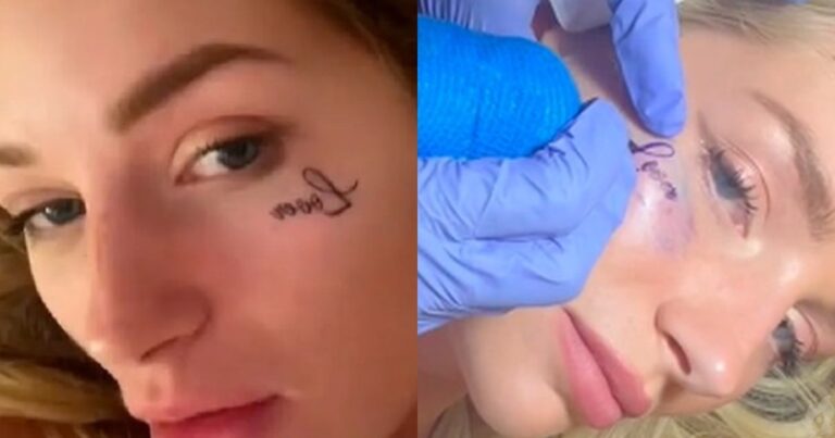 Aos 25 anos, celebridade enche a cara e acaba com tatuagem ‘Amante’ no rosto