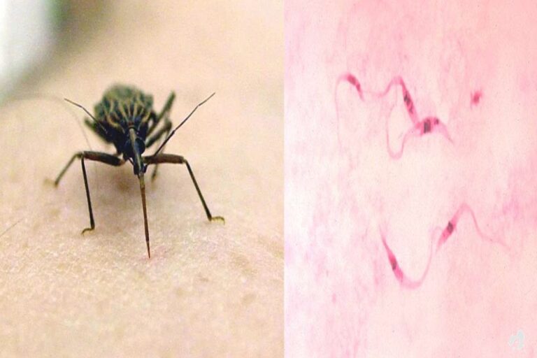 Chagas: mais de 1,2 milhão de brasileiros tem a doença, porém 70% não tem conhecimento
