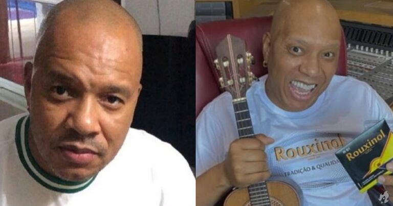 Anderson Leonardo, do Molejo, recebe alta da UTI e estado de saúde é estável