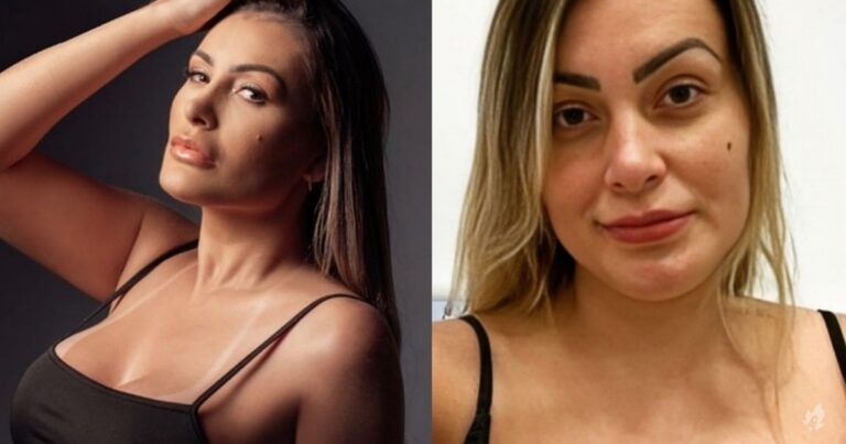Após cirurgia de emergência, Andressa Urach volta a ser internada