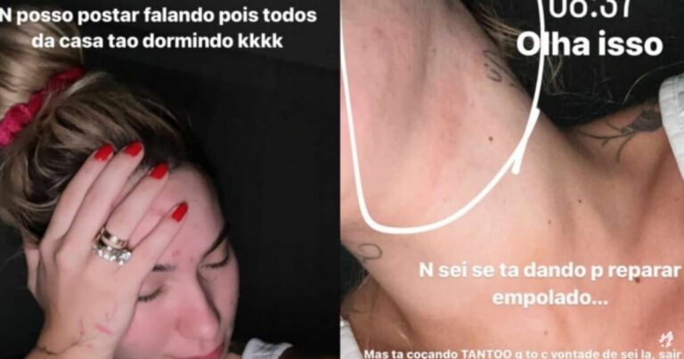 Virginia Fonseca mostra corpo marcado após passar mal pela segunda vez
