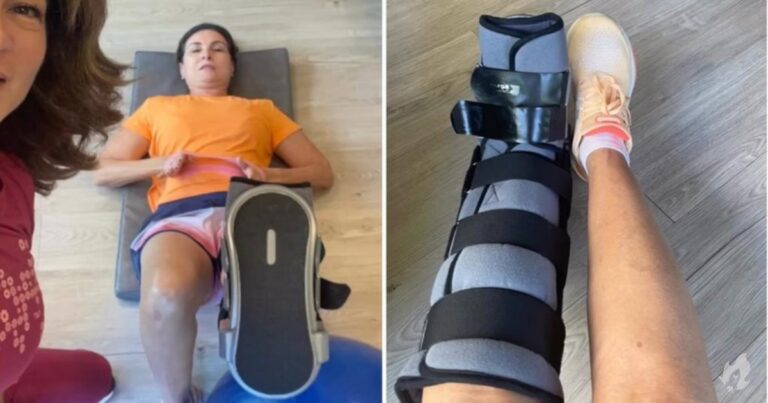 Com o pé quebrado, Fátima Bernardes faz exercícios e fisioterapia: ‘Não posso parar’
