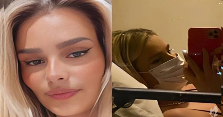 Yasmin Brunet explica como fraturou sua costela e já recebeu alta de hospital – vídeo