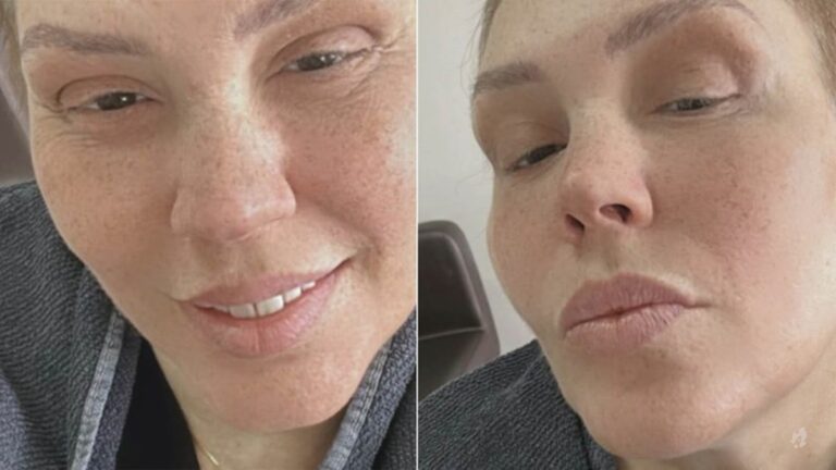 Simony exibe seu cabelo natural após tratamento contra o câncer