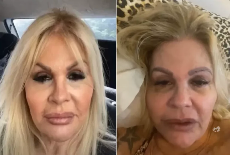 Com sintomas de dengue, Monique Evans leva susto e vai parar em hospital no Rio