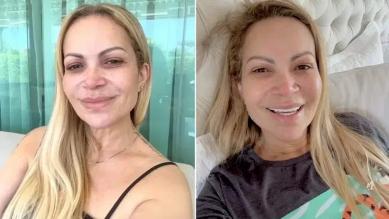 Solange Almeida passa por cirurgia de emergência