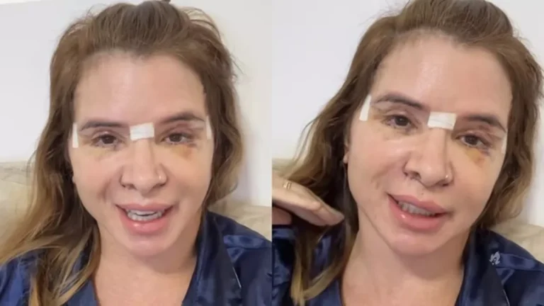 Mãe de Viih Tube entrega detalhes sobre recuperação depois de passar por cirurgias plásticas