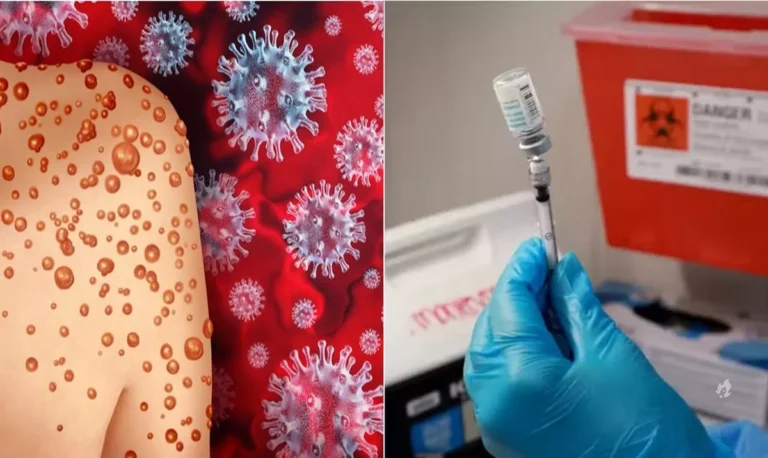 Mpox: entenda o surto com variante mais letal