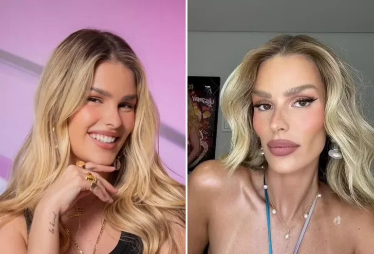 Yasmin Brunet se cansa e desabafa após críticas sobre seu rosto: ‘Quem tem que gostar sou eu’