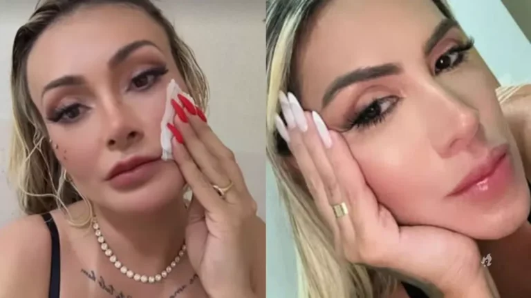 Andressa Urach apanha de Juju Ferrari é hospitalizada e faz desabafo: ‘Vai ter volta’