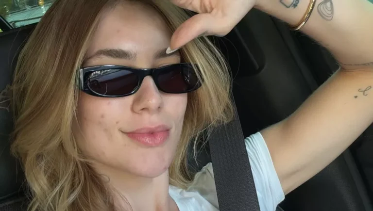 Influenciadora Virginia Compartilha Luta Contra Enxaqueca e Decisões que Agravaram a Doença